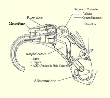 Cosa sono e come funzionano gli apparecchi acustici